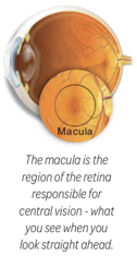 diabetic retinopathy macula