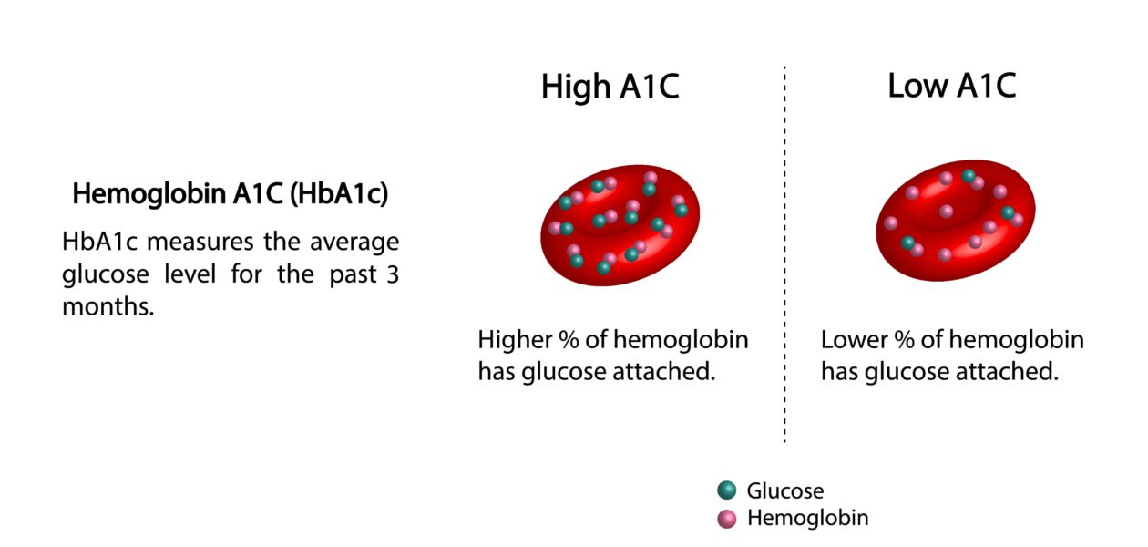 HbA1c measures the average glucose level for the past 3 month